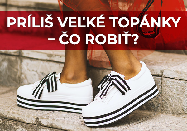 Príliš veľké topánky – čo robiť?